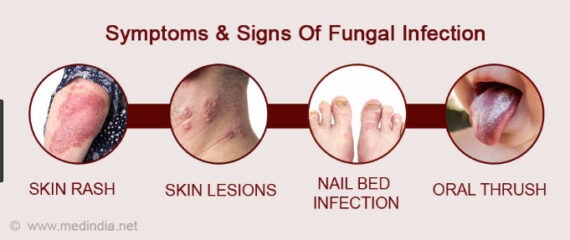 Fungal Infection